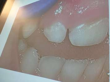 Windsor-Essex County Health Unit recommends fluoride in county water system. June 6, 2018. Photo by Paul Pedro)