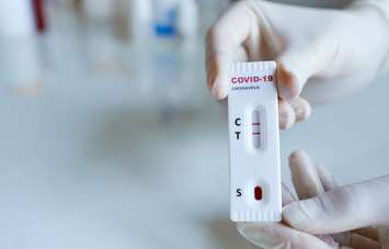 Medic hands in gloves holding positive covid-19 test, rapid test kit for diagnosis coronavirus infection. © Can Stock Photo / vitaliymateha