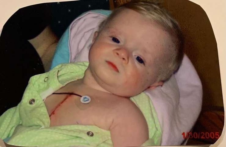 Maia Godin at eight months old after open heart surgery (Photo courtesy of Children's Health Foundation)