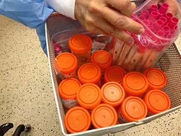 Urine samples for testing Apr 23 2015 (Photo by Simon Crouch) 