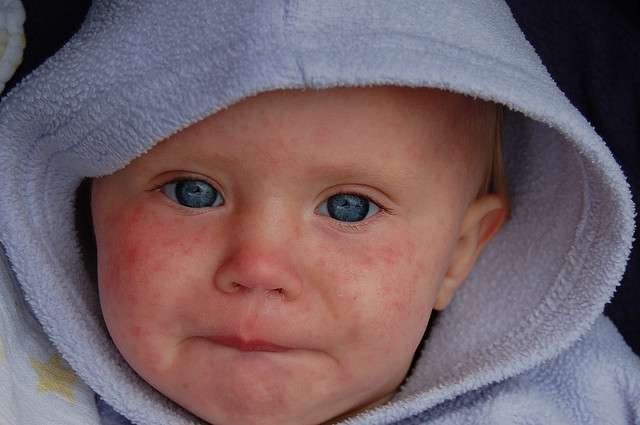 Additional measles exposure sites popping up across CK