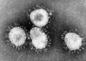 The coronavirus is named after its shape which resembles the corona of a star. (Photo courtesy of Wikipedia)