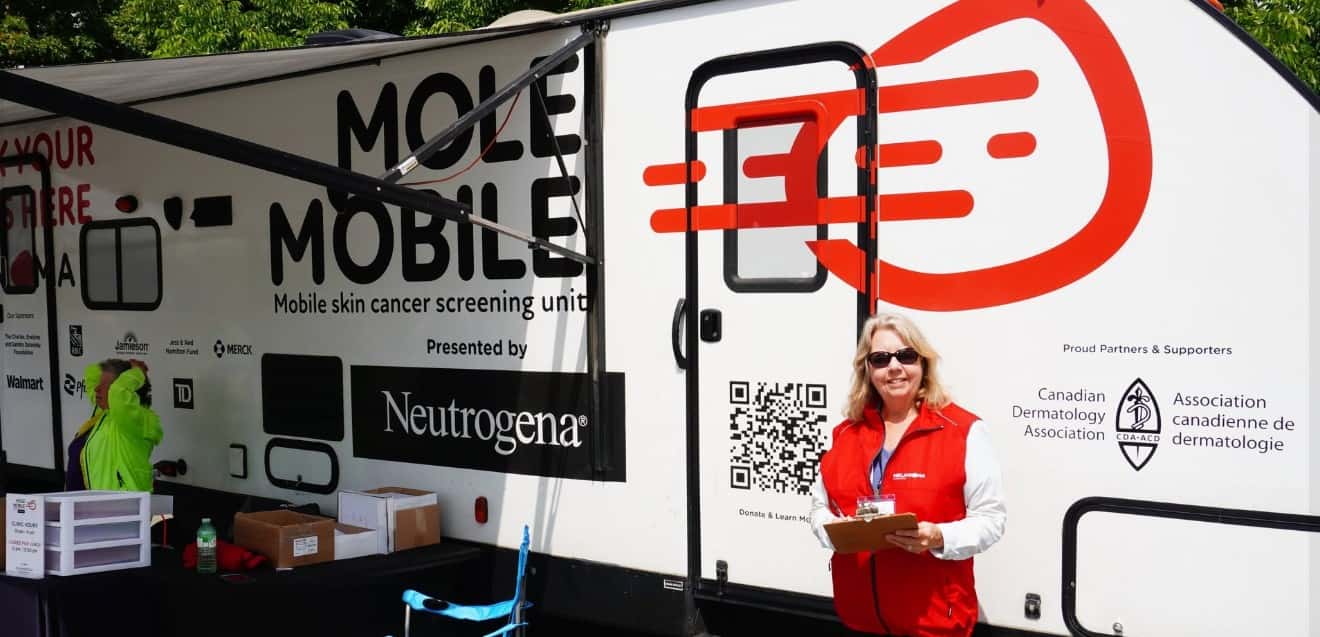 Melanoma Canada 'Mole Mobile' stops in Sarnia this Friday