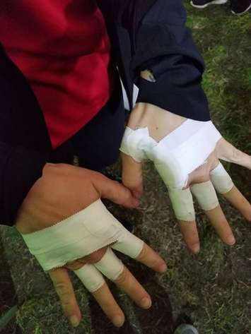 Jennifer Tape-Samson's hands taped up at the OCR World Championships in England. (Submitted photo)