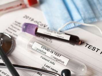Coronavirus test concept with blood test tubes, test form and other medical objects
© Can Stock Photo / alexbowmore